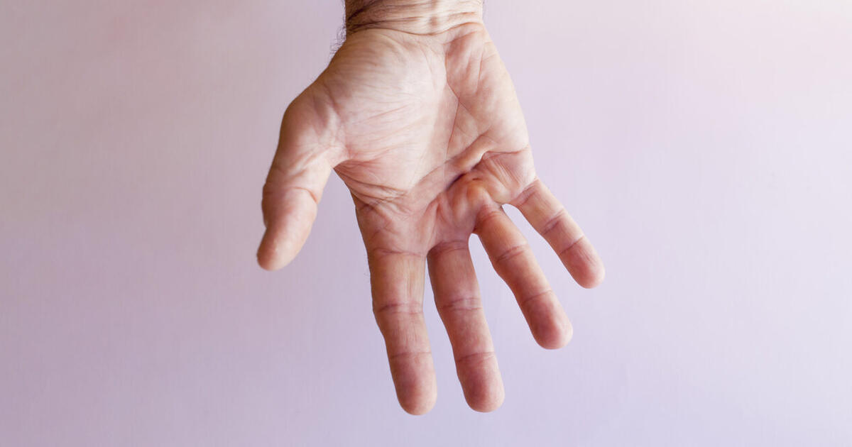 Knoten In Der Handfläche Behandlung www.kantonsspitalbaden.ch