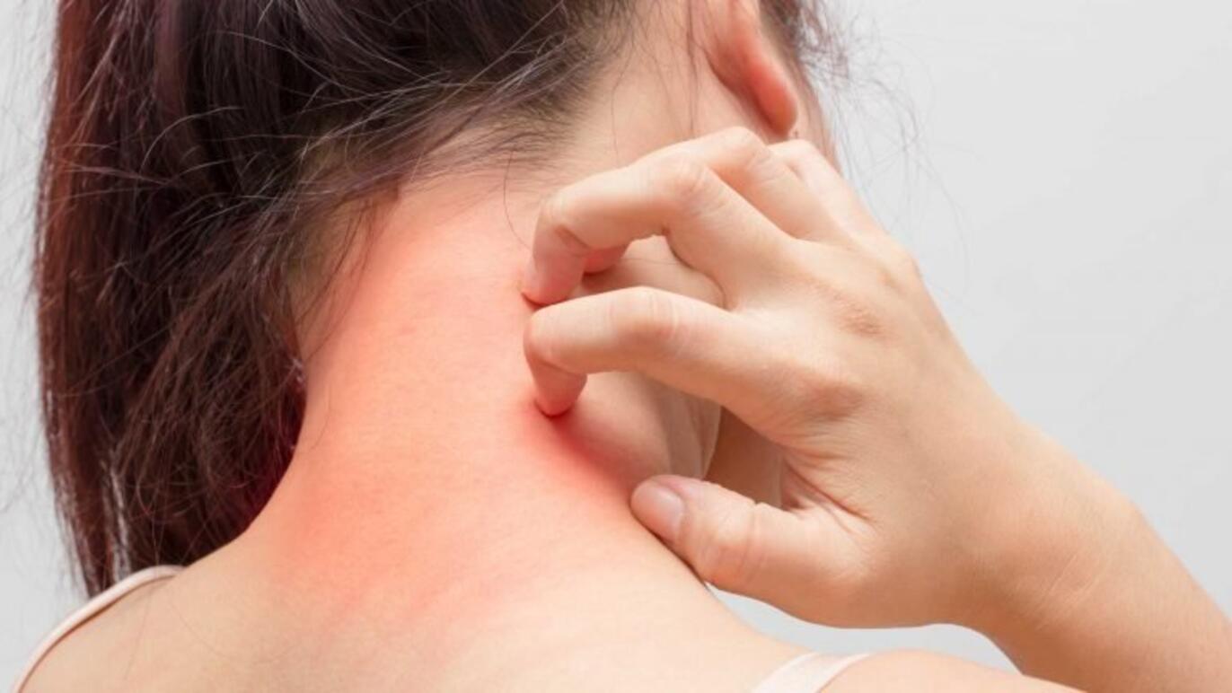 ksb_blog_allergie_content-768x432.jpg