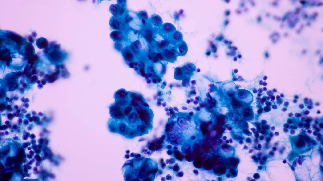 ksb-blog-pathologie-content2-2048x1152.jpg