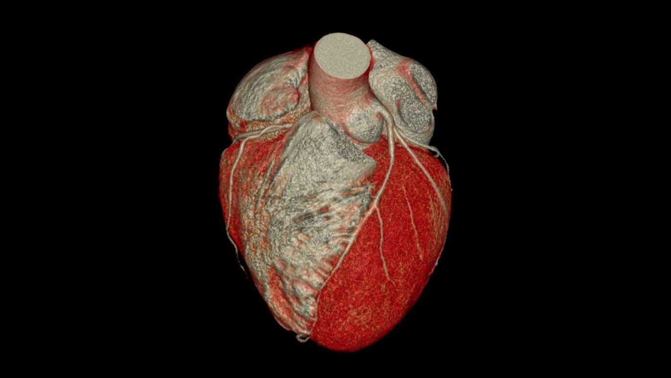 ksb_blog_faq-radiologie_ct.jpg