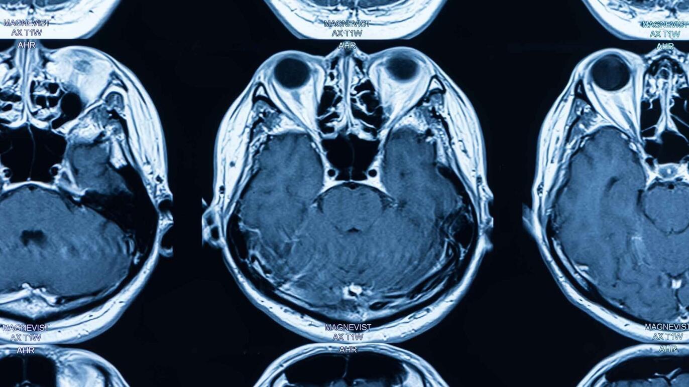 ksb_blog_faq-radiologie_mri.jpg