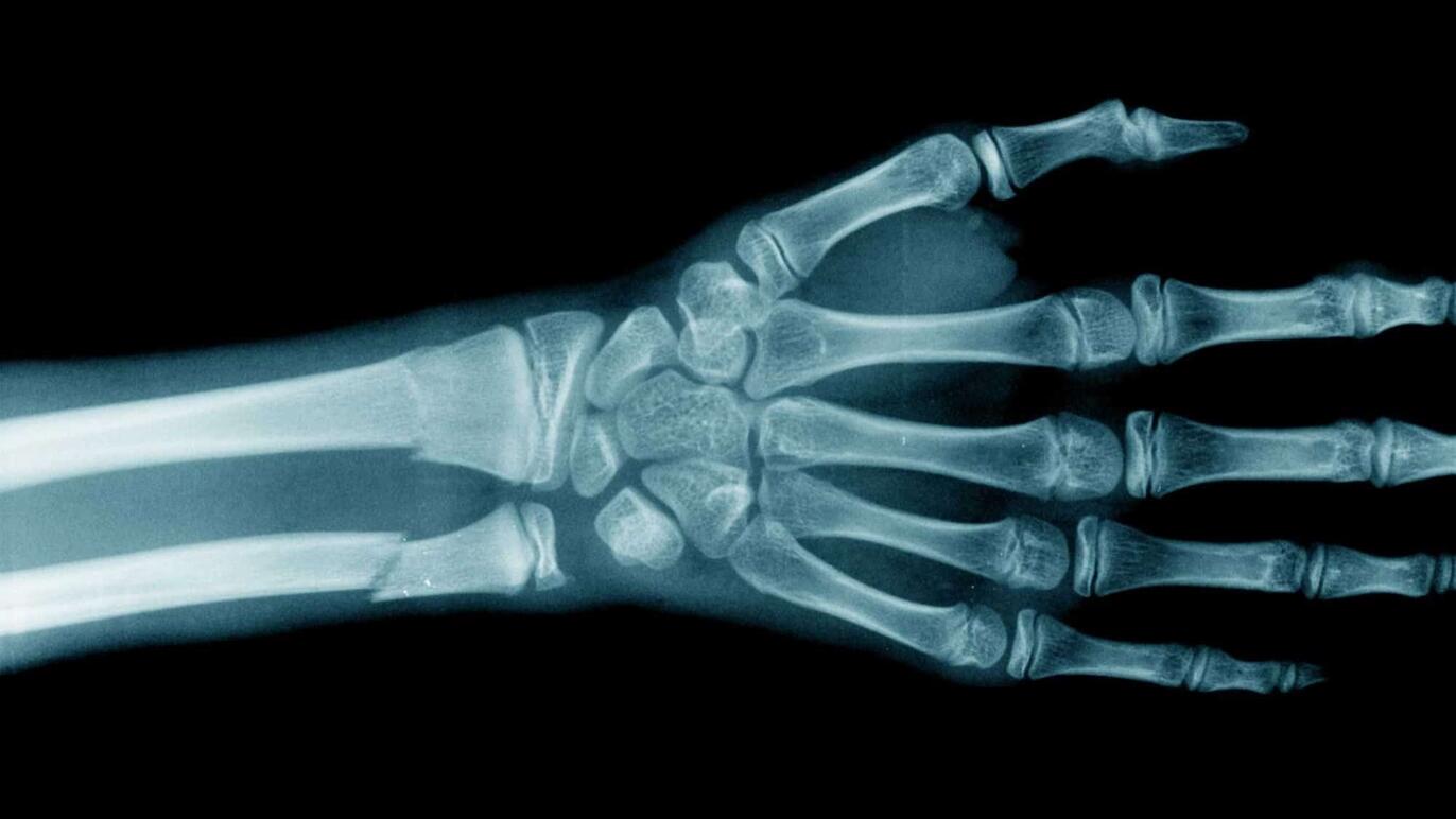 ksb_blog_faq-radiologie_roentgen.jpg