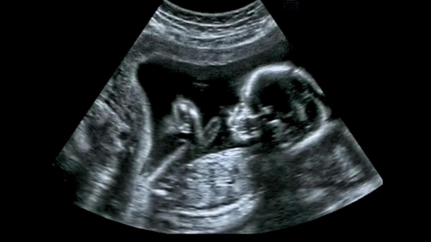 ksb_blog_faq-radiologie_ultraschall.jpg