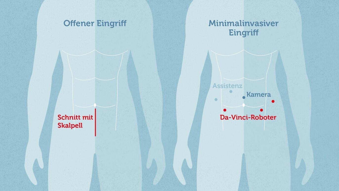 davinci_schnittfuehrung_korr2.jpg
