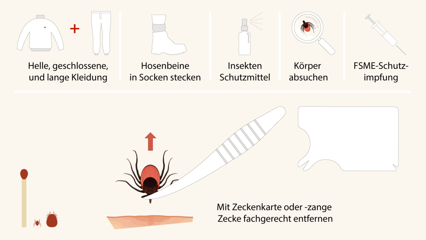 Zeckenbiss Vorgehen