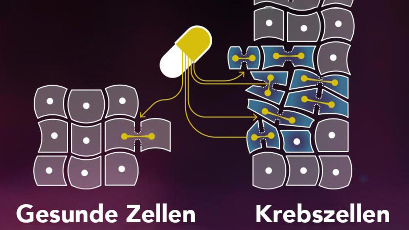 Chemotherapie Darmkrebs