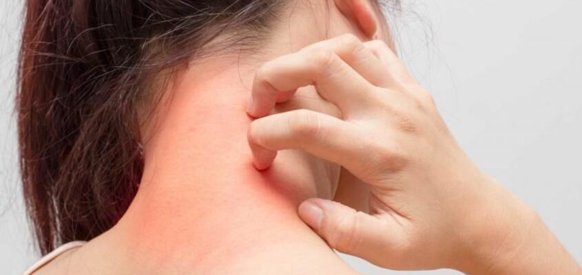 ksb_blog_allergie_content-768x432.jpg