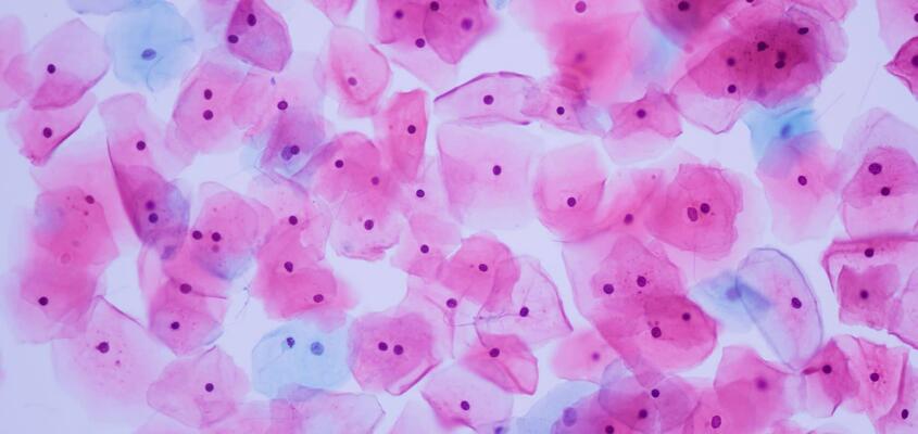ksb-blog-pathologie-content1-2048x1152.jpg