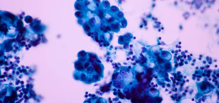 ksb-blog-pathologie-content2-2048x1152.jpg