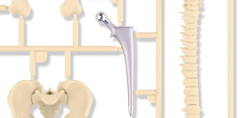 ksb-blog_implantate_content-2048x1152.jpg