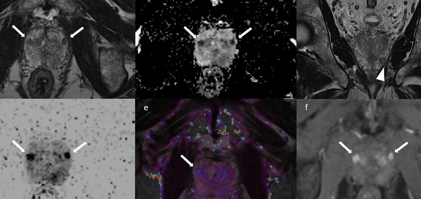 ksb-prostatamri-mri-2048x1152.jpg