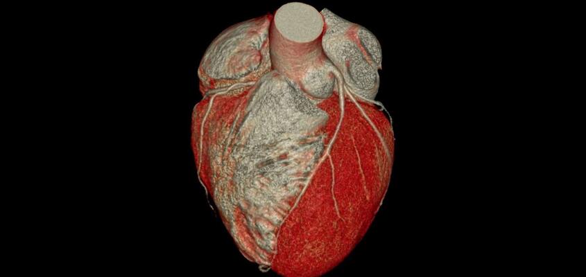ksb_blog_faq-radiologie_ct.jpg