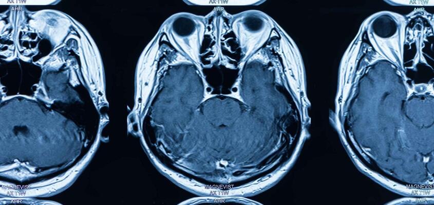ksb_blog_faq-radiologie_mri.jpg