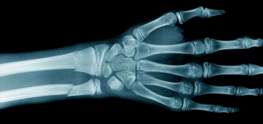 ksb_blog_faq-radiologie_roentgen.jpg