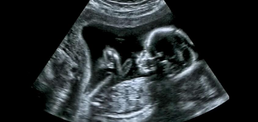 ksb_blog_faq-radiologie_ultraschall.jpg