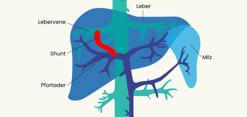 leber_shunt-2048x1152.jpg