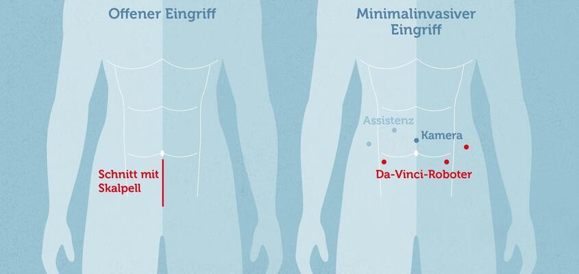 davinci_schnittfuehrung_korr2.jpg