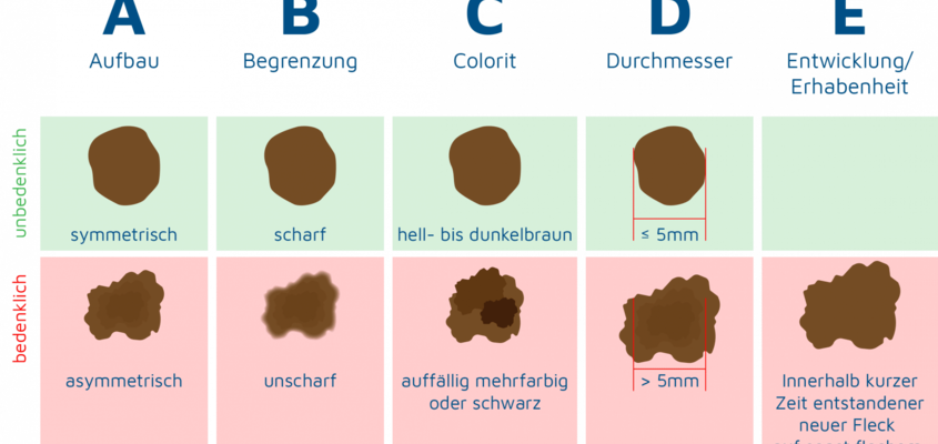 ABCDE Regel