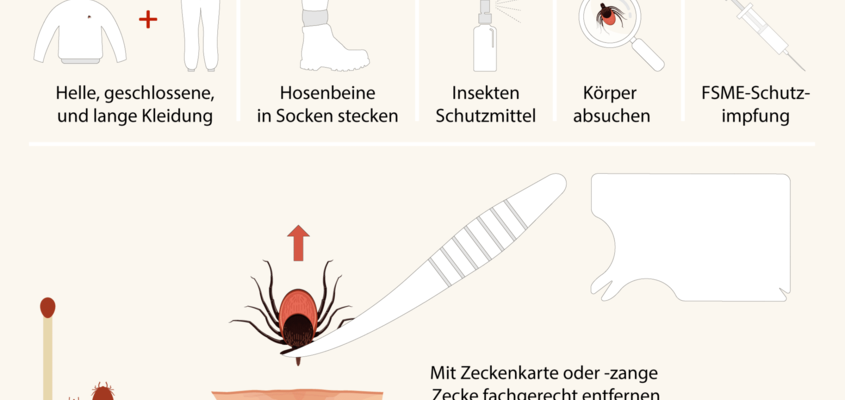 Zeckenbiss Vorgehen