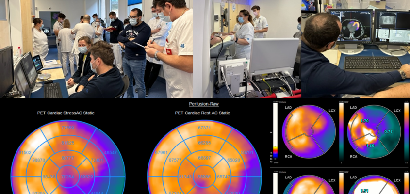 Premiere für das KSB: Impressionen von der ersten Rubidium-PET/CT-Untersuchung