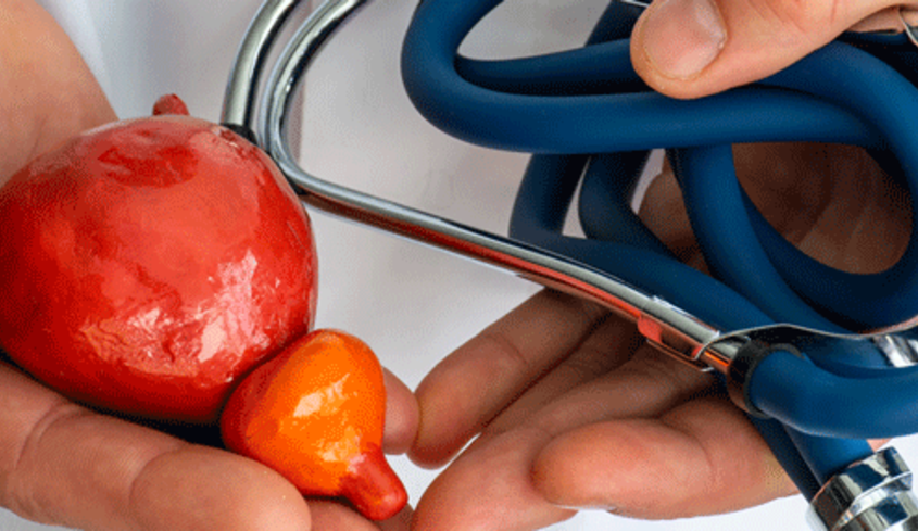Prostata_MRI Blog Artikel